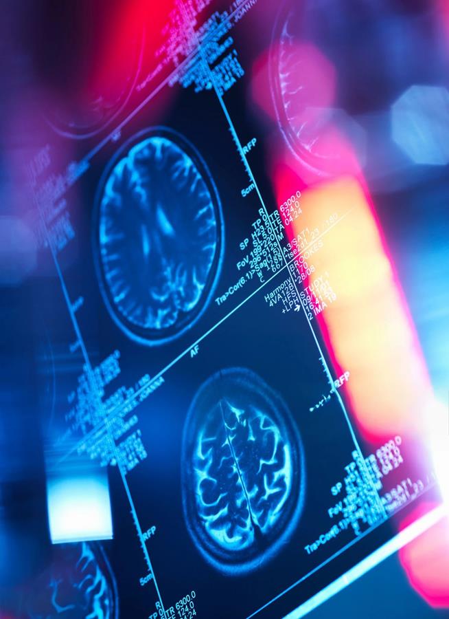 Neurologie