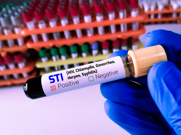 PrEP: heeft het klinisch zin asymptomatische soa's te behandelen?
