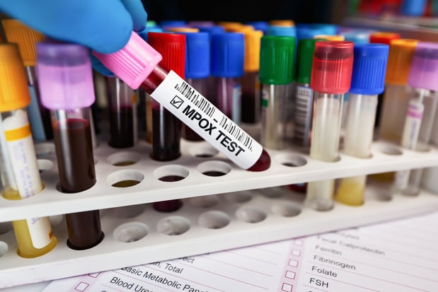 Uitbraak mpox-epidemie mogelijk door conflict in Oost-Congo
