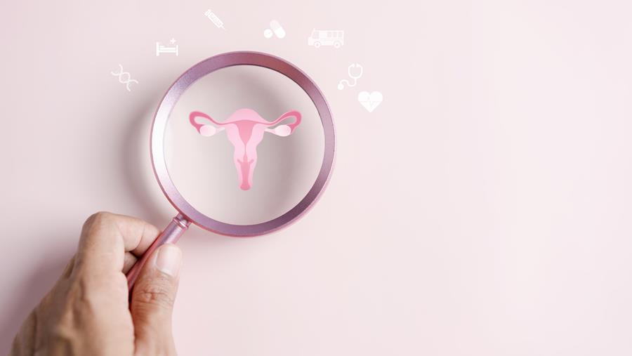 Zeg niet meer PCOS tegen PMOS