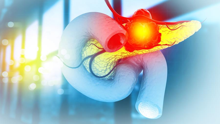 Aanval op pancreaskanker ingezet